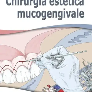 Soddisfatti O Rimborsati Chirurgia estetica mucogengivale