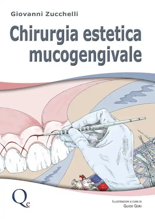 Soddisfatti O Rimborsati Chirurgia estetica mucogengivale