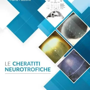 Le cheratiti neurotrofiche Prezzo Di Fabbrica
