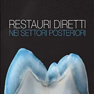 Restauri diretti nei settori posteriori Sconto