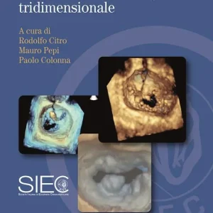 Manuale di ecocardiografia tridimensionale Offerta Limitata