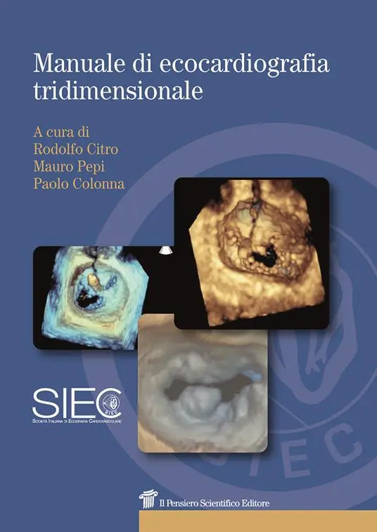 Manuale di ecocardiografia tridimensionale Offerta Limitata