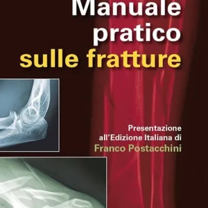 Manuale pratico sulle fratture A Buon Prezzo