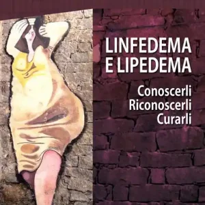 Linfedema e lipedema. Conoscerli. Riconoscerli. Curarli Subito Disponibile