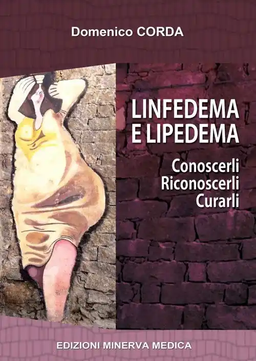 Linfedema e lipedema. Conoscerli. Riconoscerli. Curarli Subito Disponibile